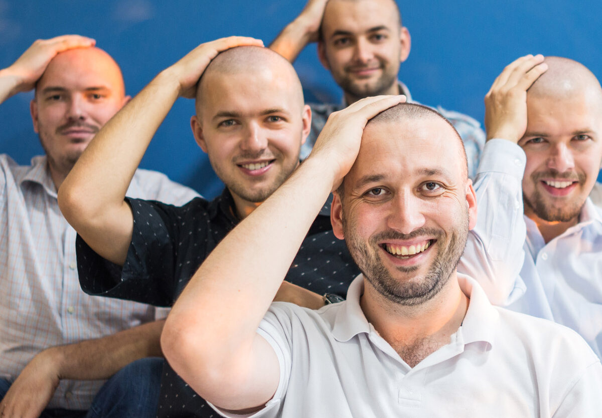 How scalp micropigmentation helps individuals with hair loss issues?